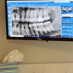 White Oak Dental Care - This was the x-ray from the prosthodontics office.