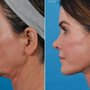 Photo of Ponsky Facial Plastic Surgery