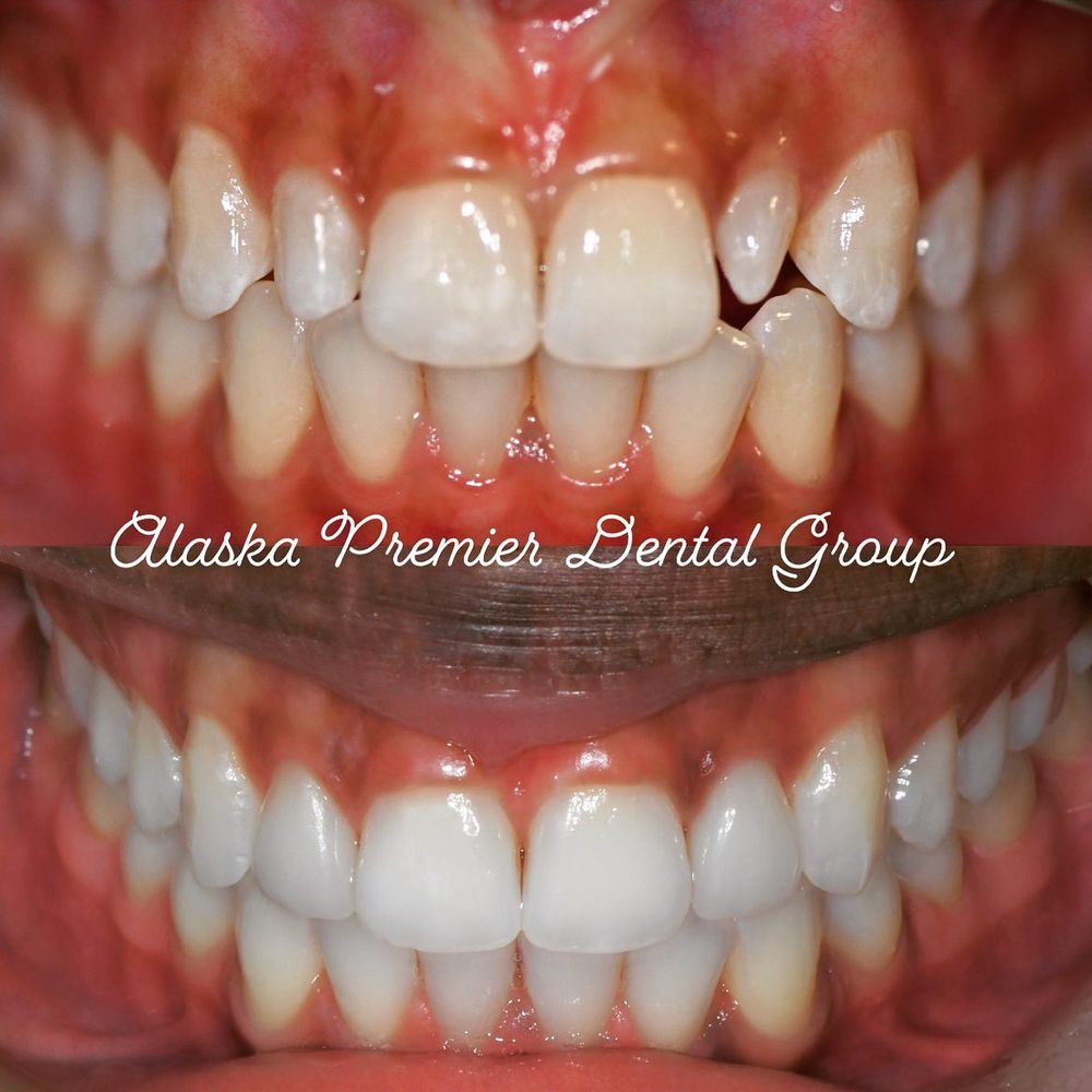 ALASKA PREMIER DENTAL GROUP Updated May 2024 48 Photos & 11 Reviews