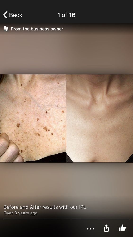 LASERCOSMEDIX 17 Photos 466 Old Hook Rd, Emerson, New Jersey