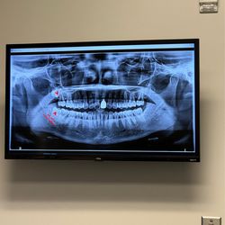 Atlanta Oral & Facial Surgery - my teeth