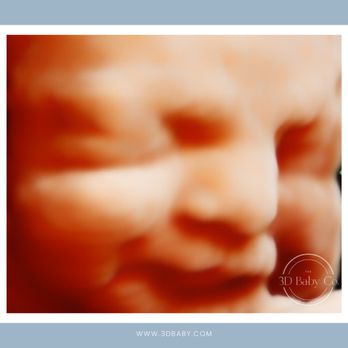 The 3D Baby Co. - Baby showing off a sly smile in this 3D ultrasound image! (early third trimester) - Ultrasound Imaging Centers Near Me The 3D Baby Co. - Baby showing off a sly smile in this 3D ultrasound image! (early third trimester) - Ultrasound Imaging Centers Near Me