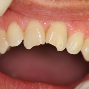 Ronald S Ghiz, DDS - Bicycle Accident - General Dentistry Near Me - New York, New York Ronald S Ghiz, DDS - Bicycle Accident - General Dentistry Near Me - New York, New York