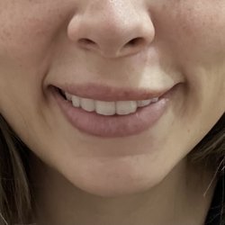 Ajliss Medical Aesthetics - San Dimas