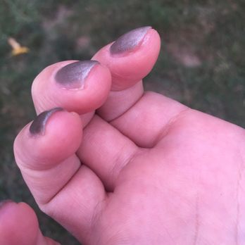 Attractive Nail & Spa - Polish on skin, after I peeled most of it off. - Nail Salons Near Me - Watertown, Massachusetts