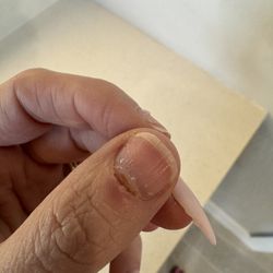 Perry Nail Salon - Torn up cuticle, these can easily get infected. From filing way too close & way too hard.
