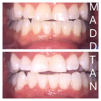 MaddTan - Skin Care Near Me - Albuquerque, New Mexico MaddTan - Skin Care Near Me - Albuquerque, New Mexico