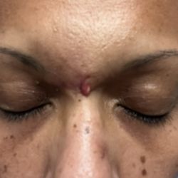 Plastic Surgery Group - I saved my life with homo homeopathic ingredients, holistic