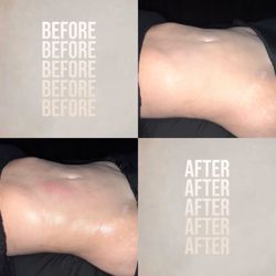 The Tox Scottsdale - So much relief in one session