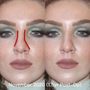 Photo of Pacific Heights Plastic Surgery