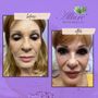 Photo of Allure Med Aesthetics