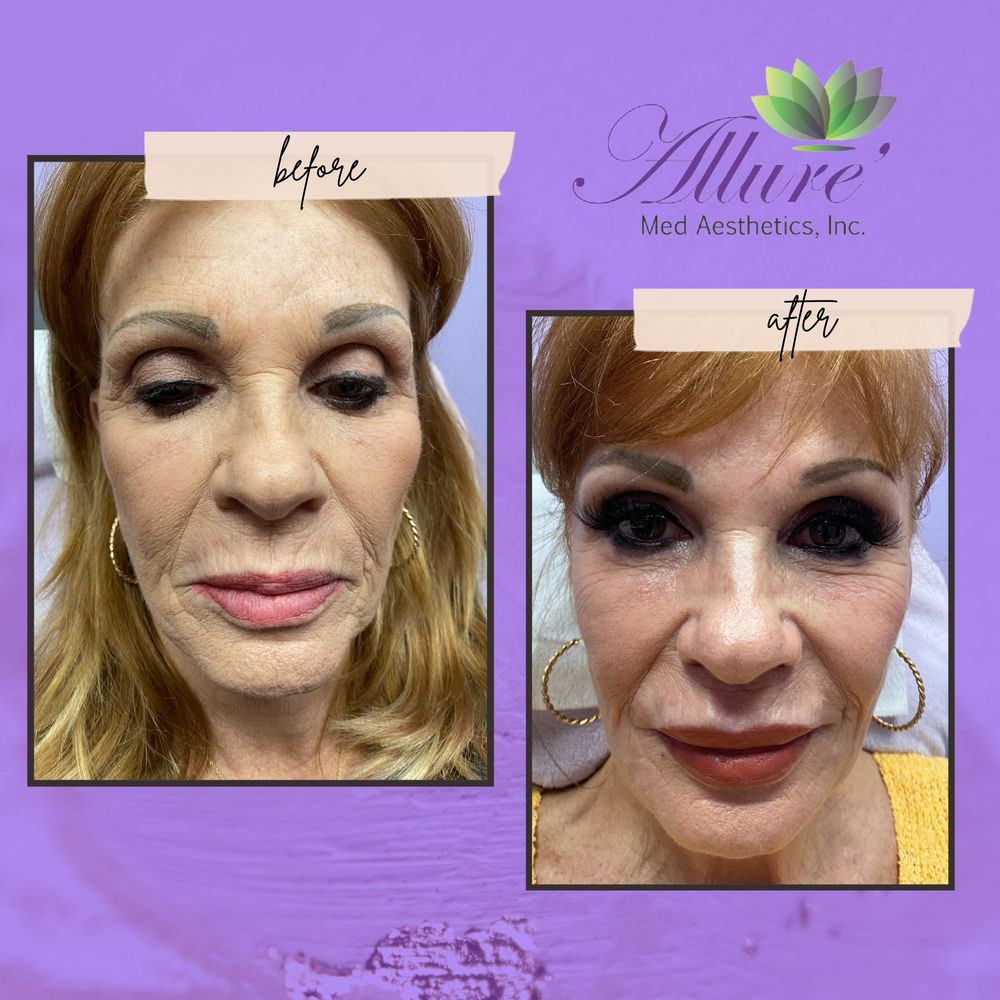 Allure Med Aesthetics Logo