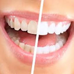 Zuzel Trujillo, DMD - Dr. Z Smiles