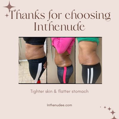 IN THE NUDE SPA - Updated September 2025 - Request an Appointment