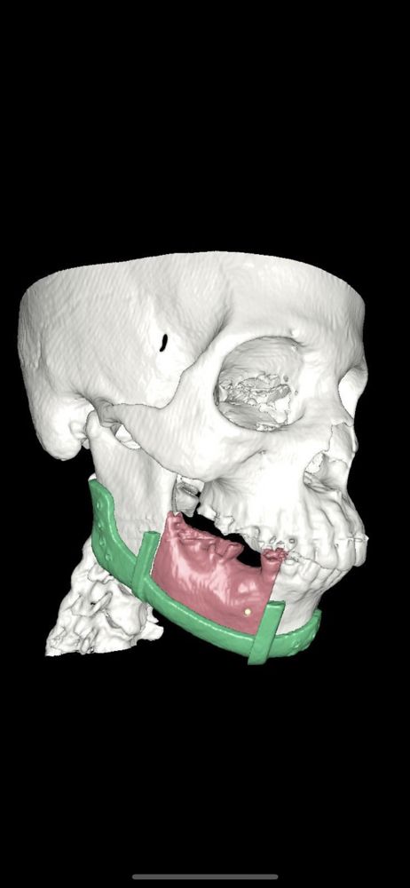 Joseph Krajekian, DMD. MD. FAAOMS - sleep specialist in Mayfield Heights, OH