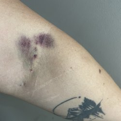 KEDPLASMA - Day 2