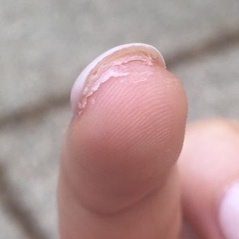 Top Coat Nail Studio - Glue/excess base was not removed post completion of the manicure - Nail Salons Near Me - Bryn Mawr, Pennsylvania Top Coat Nail Studio - Glue/excess base was not removed post completion of the manicure - Nail Salons Near Me - Bryn Mawr, Pennsylvania