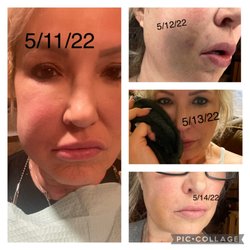 Avondale Dental