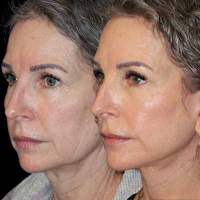 Zuliani Facial Aesthetics