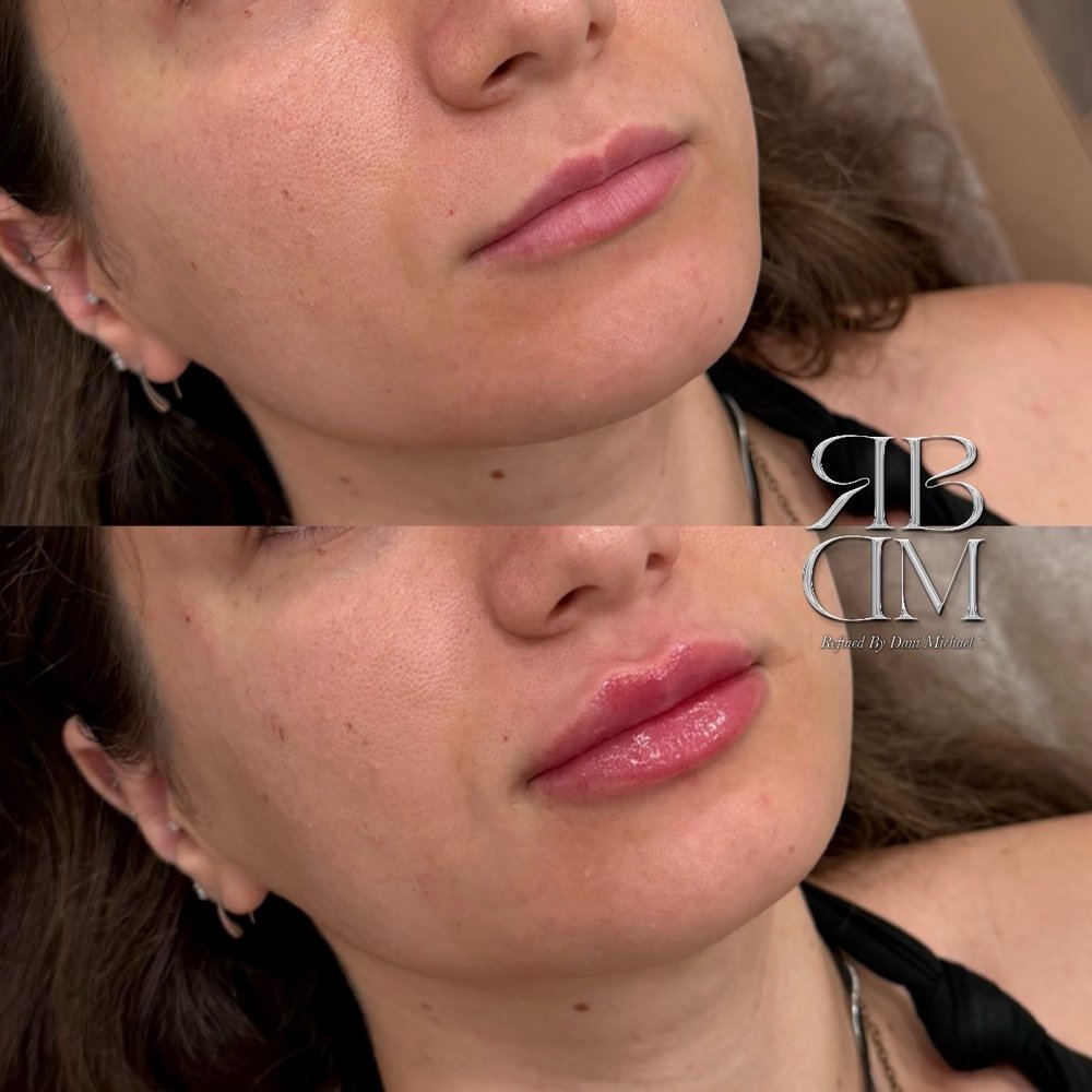vitamin b12 injections in yorba linda ca TOP 10 BEST Shots Linda, - (2026 Guide) - Quality & Affordability Pack Size:1 Vial
