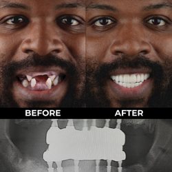 Dental Clinic Tijuana
