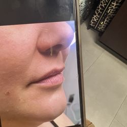 Precision Aesthetics - Before
