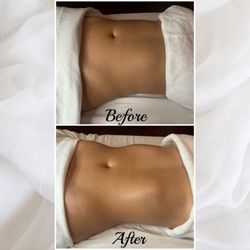 Four - Brazilian Lymphatic Drainage