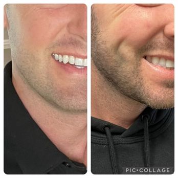 Jonathan Zelken, MD - Cosmetic Surgeons Near Me - Newport Beach, California