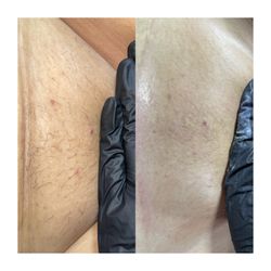 Beyond Aesthetics Spa & Wellness - Brazilian wax
