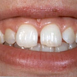 Ogontz Dental Center