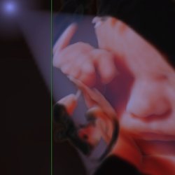 Enlightened 4D Imaging - 6/26/20 Brand New E10.