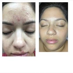 Ethereal Day Spa - After