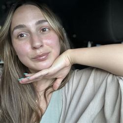 The Treatment Skin Boutique - Post Microderm facial glow