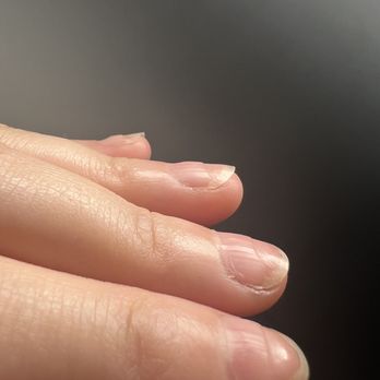 Mandy's Beauty Nails - Line of demarcation from when the man used the nail drill so deep-- down to my skin! Healthy nail growing from nail bed. - Nail Salons Near Me - Brooklyn, New York