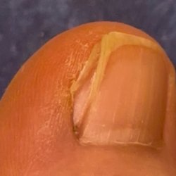 Progressive Feet