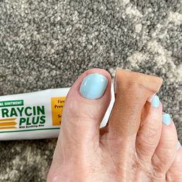 Treatment of cut toe