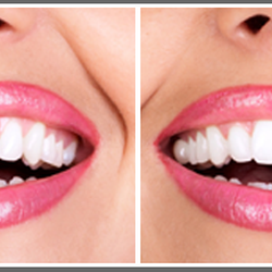 Key West Dental
