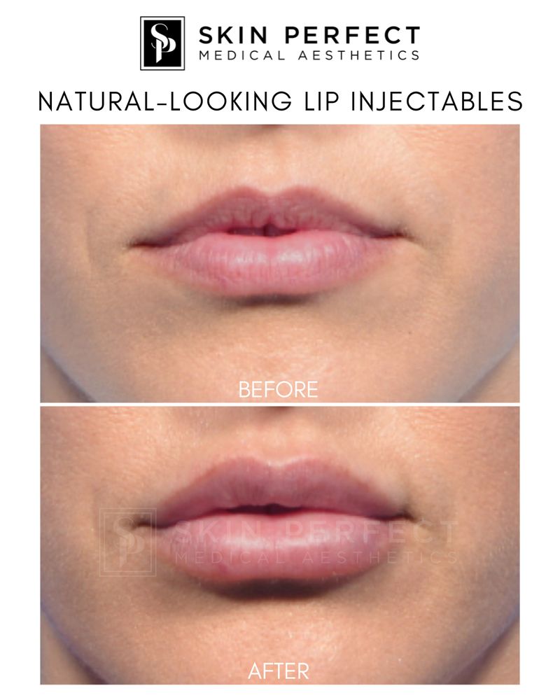 Skin Perfect Medical Aesthetics