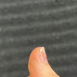 Tips and Toes Nail Salon - Nails after removal
