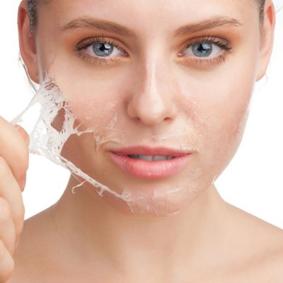 Chemical Peels - Welcome to Skin Secrets, where we offer unique and customizable treatments to address your skin concerns. Our team of knowledgeable professionals are trained to provide the highest quality of care in a relaxing and comfortable environment. Come experience the Skin Secrets difference today!