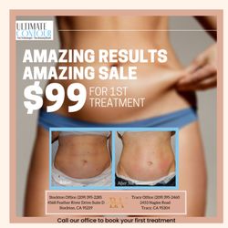 Belle Ame Med Spa & Boutique - Book your appointment now to try our Ultimate Contour for body sculpting treatments.