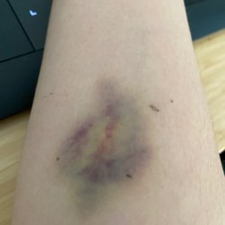 BERGEN NEW BRIDGE MEDICAL CENTER - 55 Reviews - Hospitals - 230 E