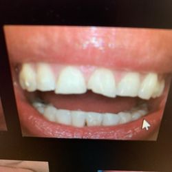 Lotus Dental Group - Before