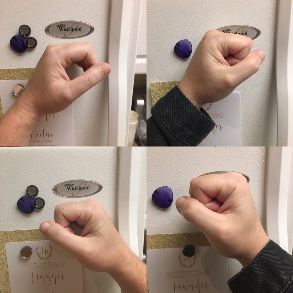 My hands were unable to close. I was 80% better after just the first 5 treatments, got to 100% after 5 more. My hands were unable to close. I was 80% better after just the first 5 treatments, got to 100% after 5 more.