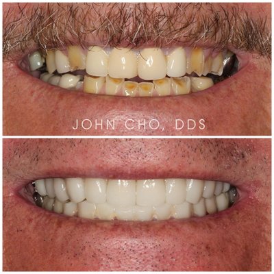 JOHN H CHO, DDS - Updated June 2026 - 48 Photos & 178 Reviews - 6226 E ...