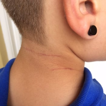 Men's World Barber Shop - Cut scrapes from his haircut visit. :( - Barbers Near Me - Miami, Florida Men's World Barber Shop - Cut scrapes from his haircut visit. :( - Barbers Near Me - Miami, Florida