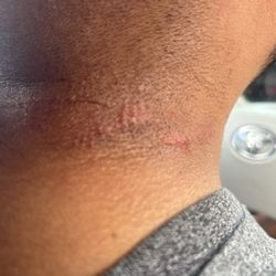 Lotus Hair and Nails - The scratch in my neck from the shaver