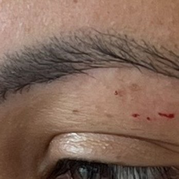 Brow Arc - Side view, Left eye brow injury - Waxing Near Me - Tacoma, Washington
