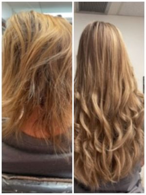 Hair Loss Alternatives