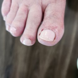 Oanh's Nails - Big toe and second toe